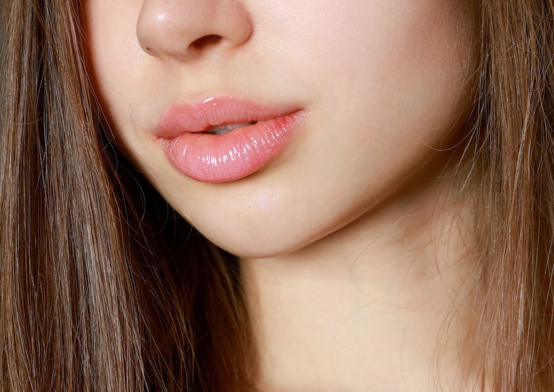 What Is Impetigo?