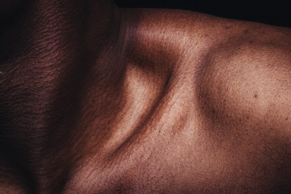Photo Skin condition