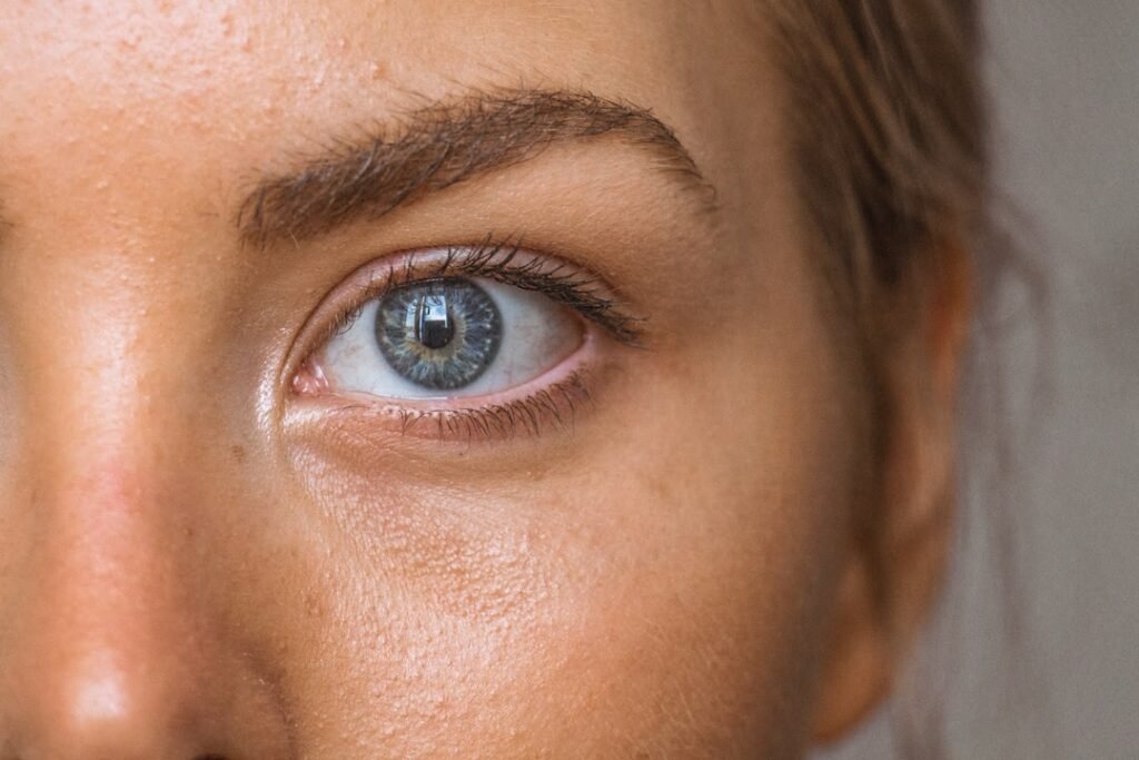 Photo Skin rash