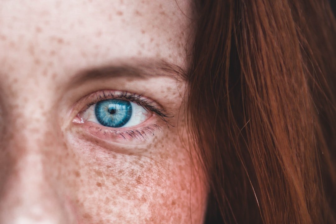 Photo Dry skin