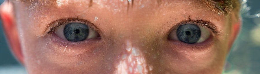 pimple inside nostril