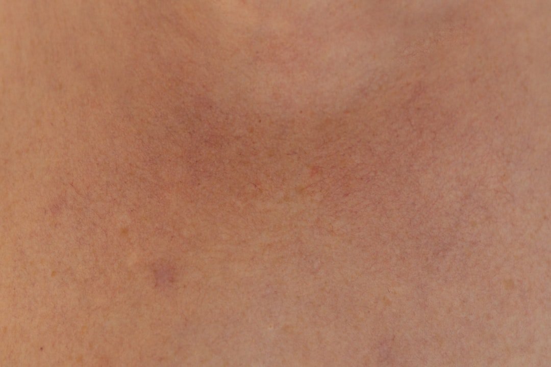 Photo pimples