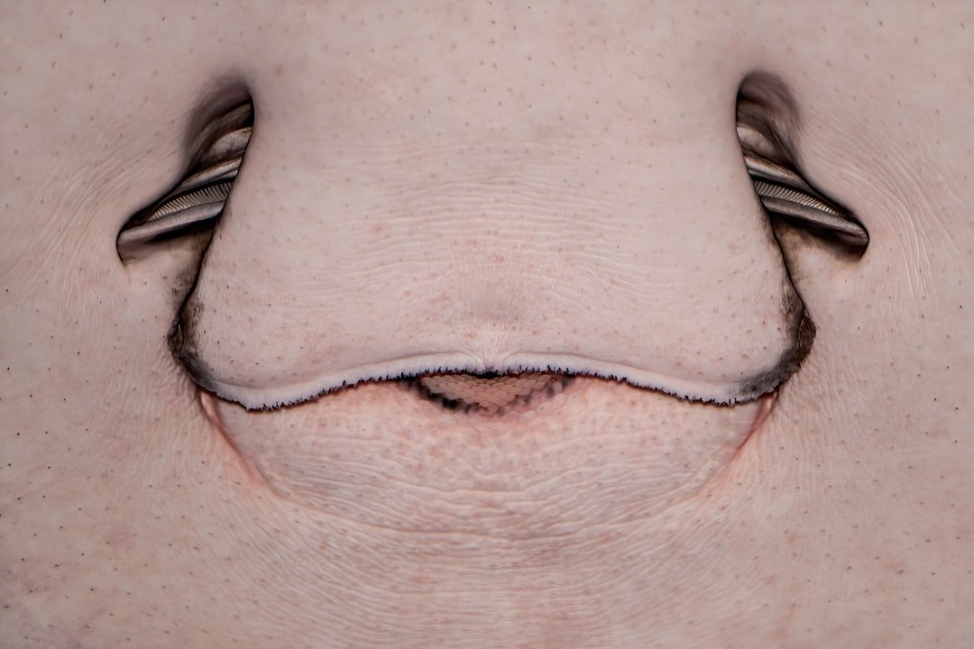 Photo vaginal pimples